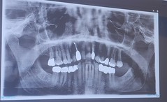 Dentist 03/18/24