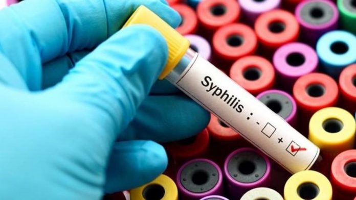 Sífilis adquirida saltou de 2 para 58 casos por 100 mil habitantes, em sete anos.| Foto: Opas