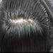 WOMEN HAIR PATCH | WIGS & EXTENSIONS