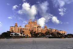Eternal Lovers Casting Shadows Across Sands Of Time (At Magical Don CeSar At Sunset) - IMRAN™